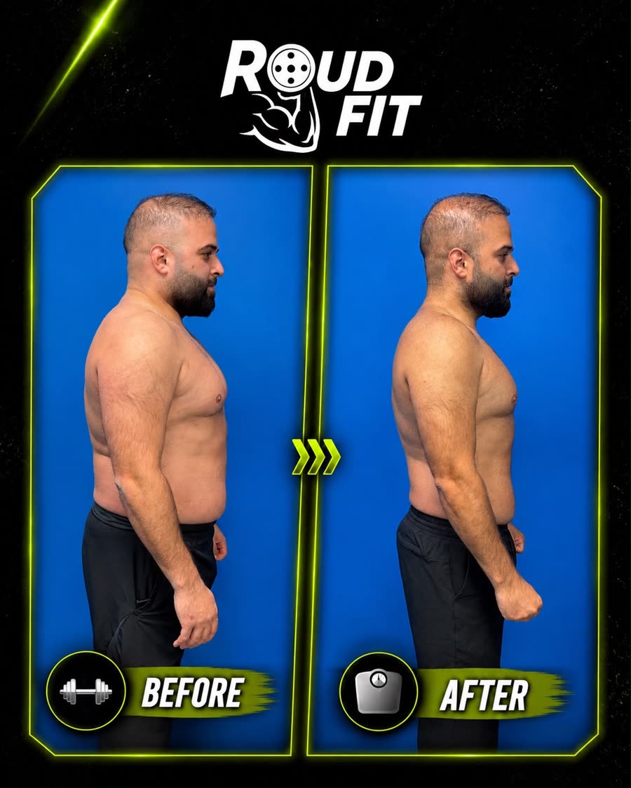 Before and after, side view of the same client